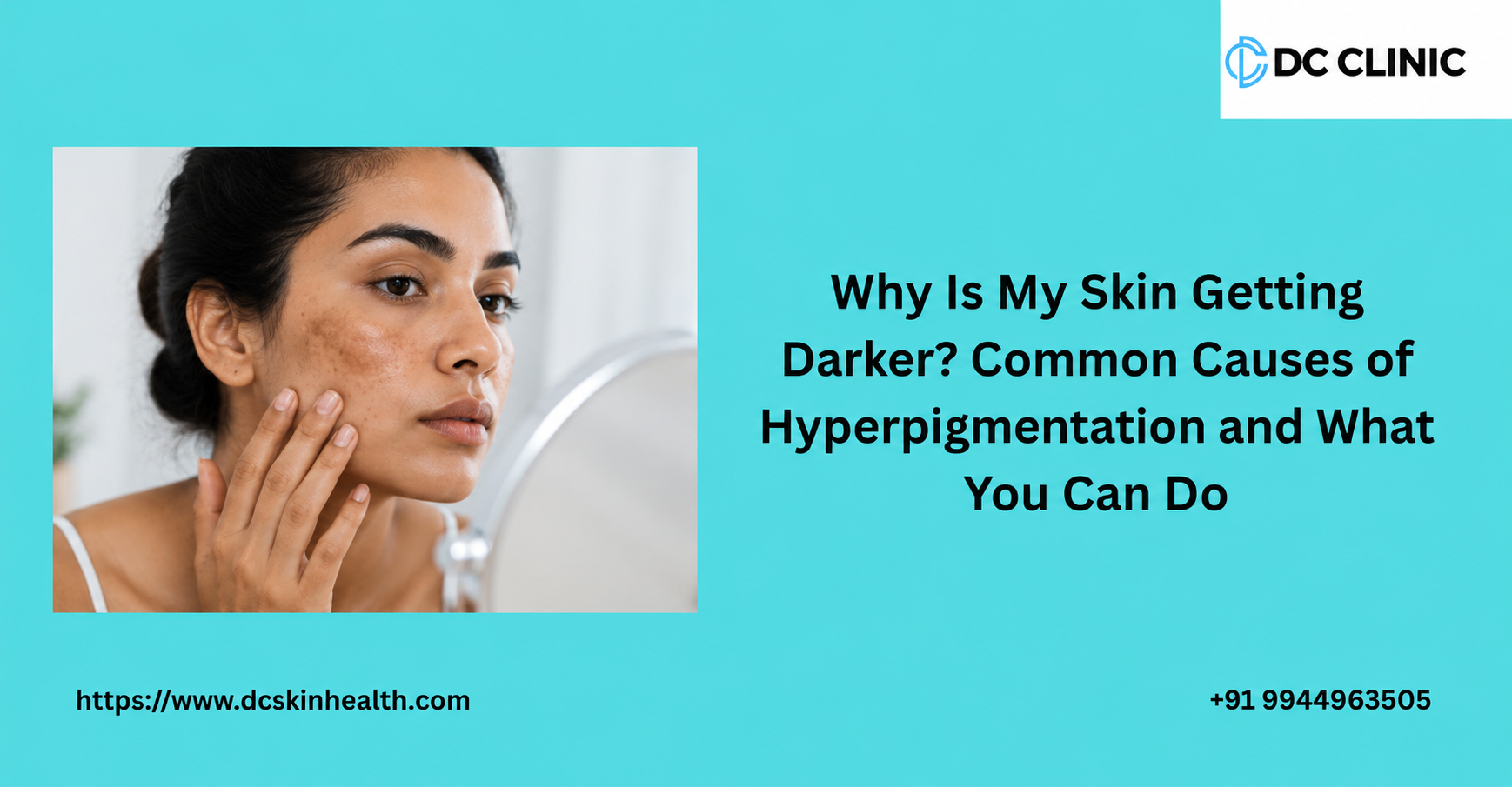 why-is-my-skin-getting-darker-common-causes-of-hyperpigmentation-and-what-you-can-do