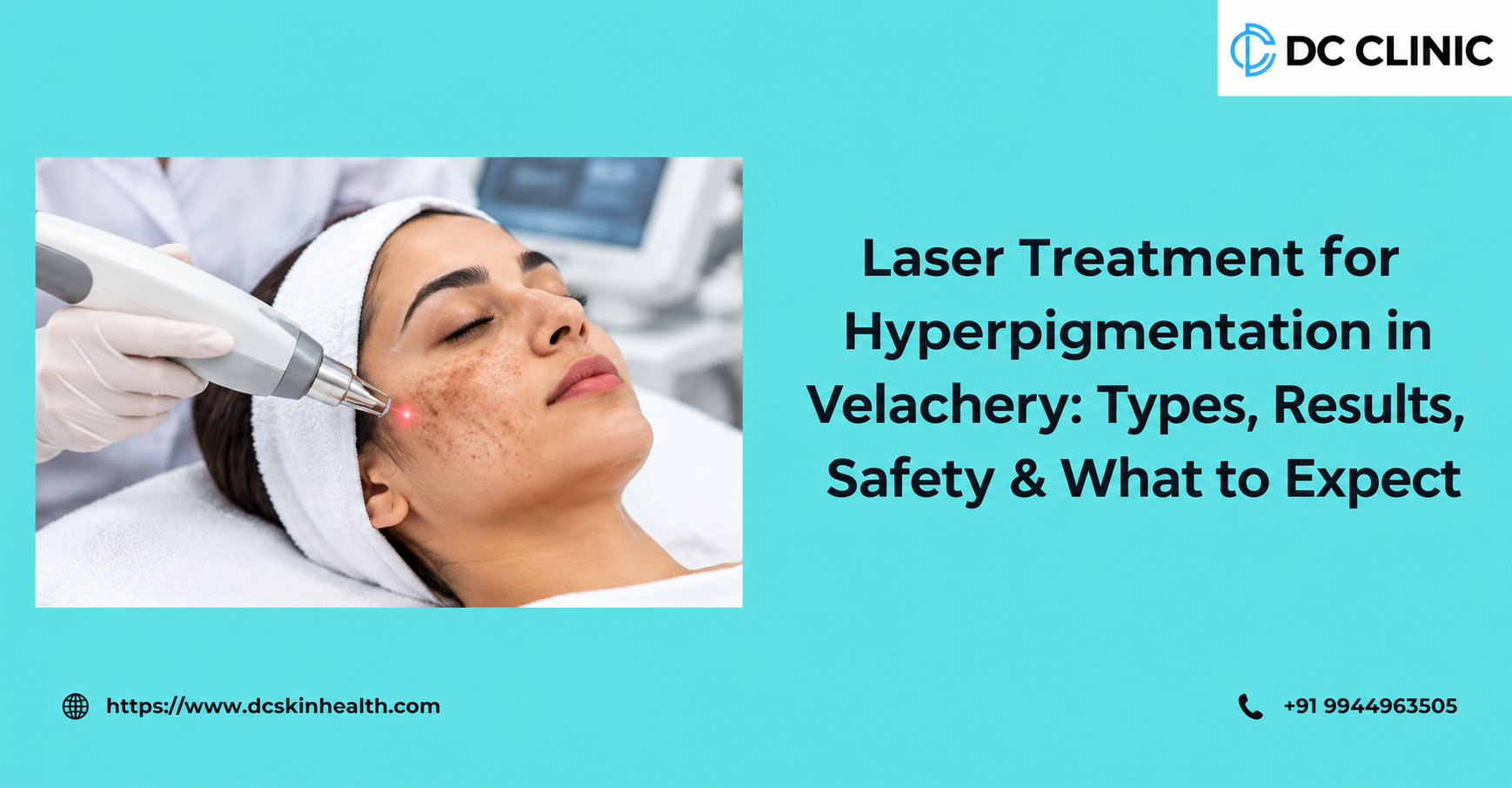 laser-treatment-for-hyperpigmentation-in-velachery-types-results-safety--what-to-expect